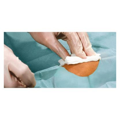 Zbliżenie na ręce w rękawiczkach, które czyszczą mały obszar skóry białą chusteczką, otoczone niebieskozielonymi samoprzylepnymi sterylnymi serwetkami Hartmann Foliodrape® Protect, indywidualnie pakowanymi, firmy Paul Hartmann AG.