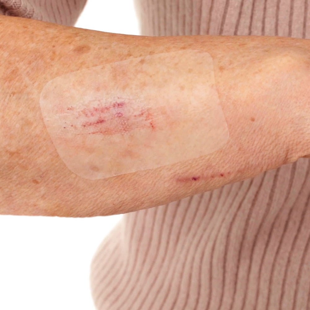 Leukomed T skin sensitive, sterylny opatrunek przezroczysty – zastosowanie