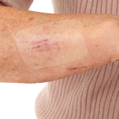 Leukomed T skin sensitive, sterylny opatrunek przezroczysty – zastosowanie