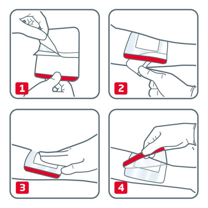 Plaster Leukoplast Leukomed T plus, sterylny z opatrunkiem – instrukcja stosowania krok po kroku